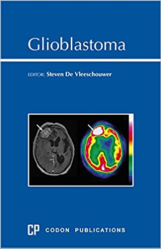 Glioblastoma