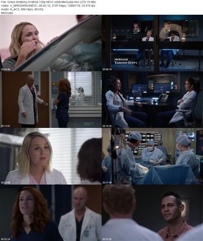 Greys Anatomy S18E04 720p HEVC x265 