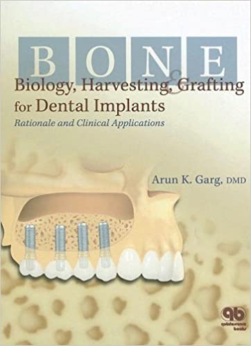 Bone Biology, Harvesting, & Grafting For Dental Implants: Rationale and Clinical Applications
