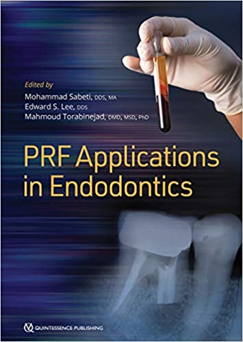 Platelet Rich Fibrin PRF Applications in Endodontics