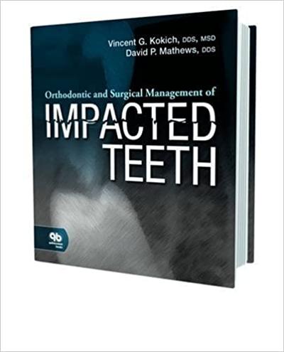 Orthodontic and Surgical Management of Impacted Teeth