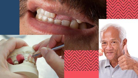 Udemy - Removable Partial Dentures