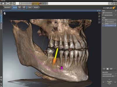 Dental Image Software Suite 1.14.0