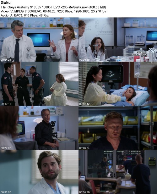 Greys Anatomy S18E05 1080p HEVC x265-MeGusta