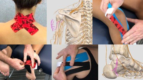 Udemy - Kinesiology Taping - A Cutaneous Nervous System Approach
