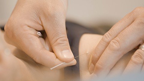 Udemy - IMS Dry Needling for Healthcare Professionals