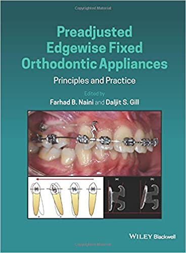 Preadjusted Edgewise Fixed Orthodontic Appliances Principles and Practice