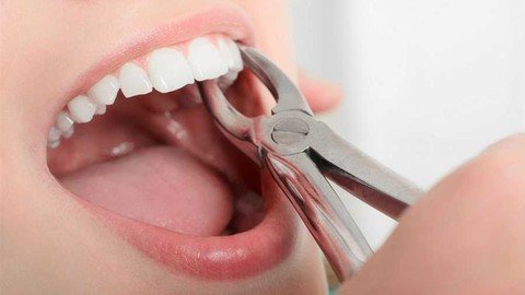 Udemy - Dental Extraction  Basic Principles, Forceps & Elevators
