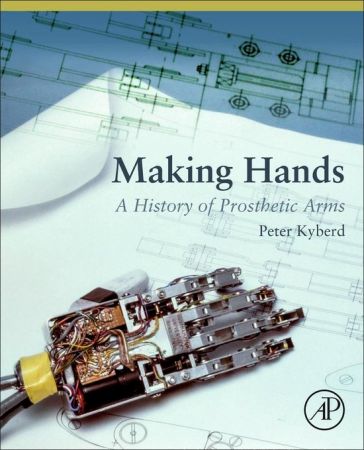 Making Hands: A History of Prosthetic Arms