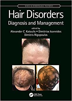 Hair Disorders: Diagnosis and Management