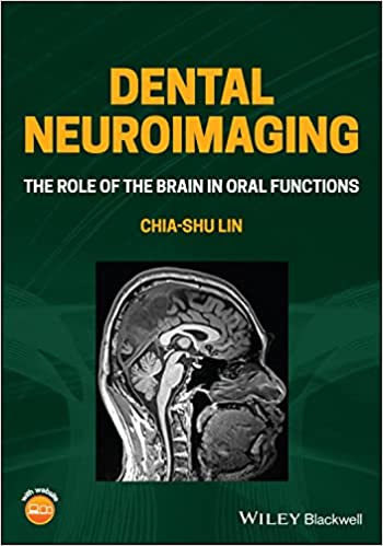 Dental Neuroimaging  The Role of the Brain in Oral Functions