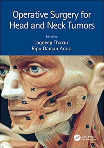 Operative Surgery for Head and Neck Tumours
