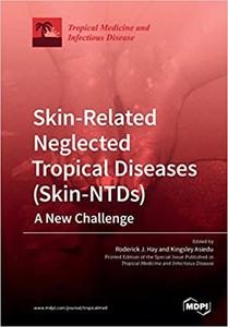 Skin-Related Neglected Tropical Diseases