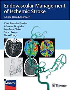 Endovascular Management of Ischemic Stroke A Case-Based Approach by Vitor Mendes Pereira, Adam A. Dmytriw