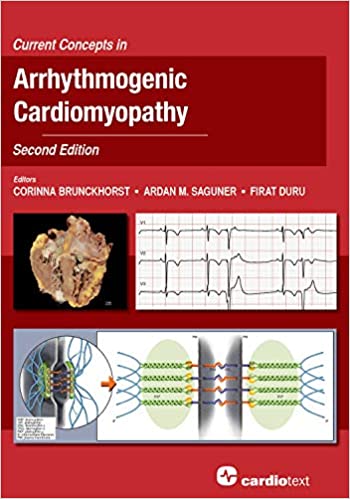 Current Concepts in Arrhythmogenic Cardiomyopathy, 2nd Edition