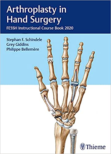 Arthroplasty in Hand Surgery FESSH Instructional Course Book 2020