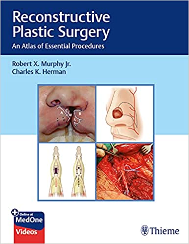 Reconstructive Plastic Surgery An Atlas of Essential Procedures