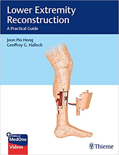 Lower Extremity Reconstruction A Practical Guide