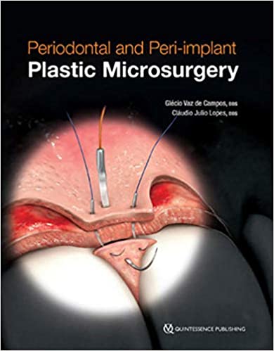 Periodontal and Peri-implant Plastic Microsurgery Minimally Invasive Techniques with Maximum Precision