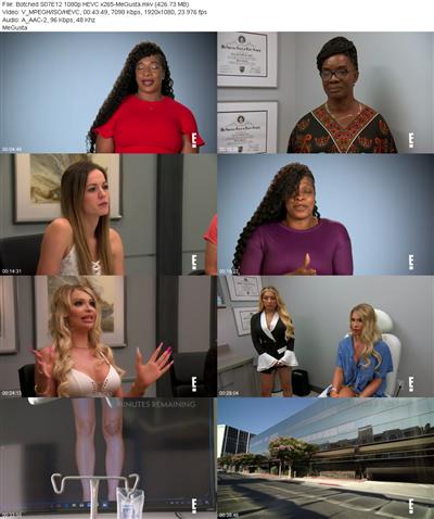 Botched S07E12 1080p HEVC x265 