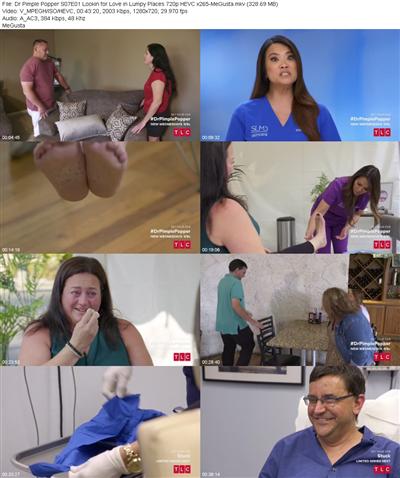 Dr Pimple Popper S07E01 Lookin for Love in Lumpy Places 720p HEVC x265 