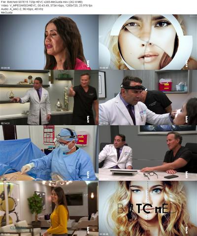 Botched S07E15 720p HEVC x265 