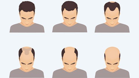 How to STOP Male Pattern Hair Loss & REGROW Your Own Hair