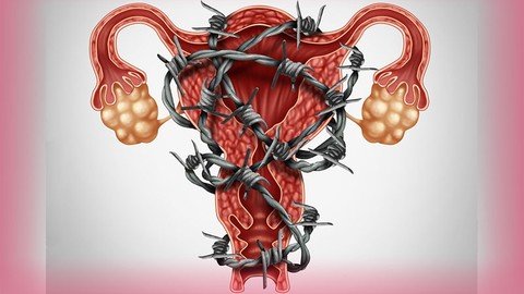 Udemy - Optimizing Fertility In Endometriosis