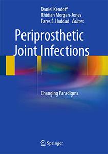 Periprosthetic Joint Infections Changing Paradigms