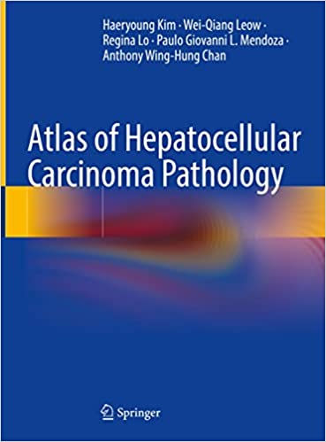 Atlas of Hepatocellular Carcinoma Pathology