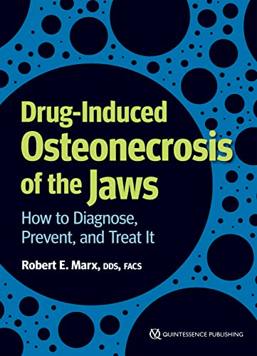 Drug-Induced Osteonecrosis of the Jaws How to Diagnose, Prevent, and Treat It
