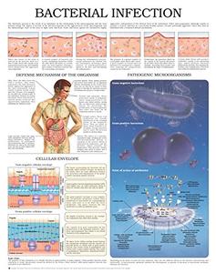Bacterial Infection e chart Full illustrated