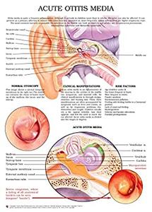 Acute otitis media e chart Full illustrated