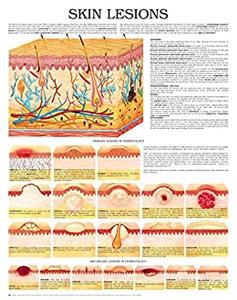 Skin lesions e chart Full illustrated