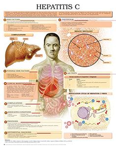 Hepatitis C e chart Full illustrated