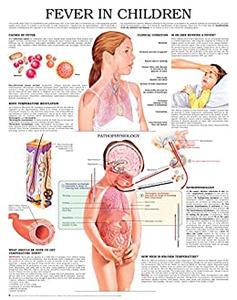 Fever in children e chart Full illustrated