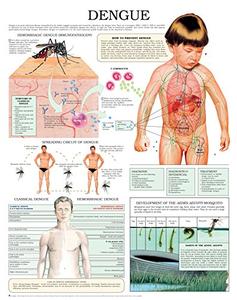 Dengue e chart Full illustrated