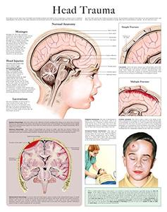 Head trauma e-chart Quick reference guide