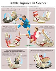 Ankle Injuries in Soccer e-chart Quick reference guide