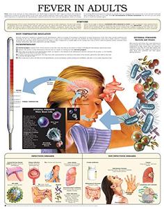 Fever in adults e chart Full illustrated