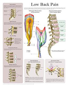 Low Back Pain e-chart Quick reference guide