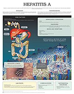 Hepatitis A e chart Full illustrated