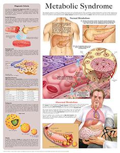Metabolic Syndrome e-chart Full illustrated