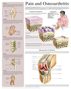 Pain and Osteoarthritis e-chart Quick reference guide