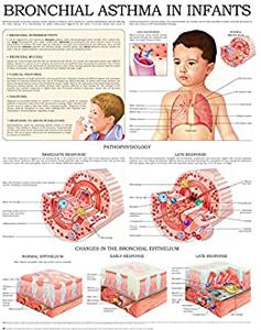 Bronchial asthma in infants e-chart Quick reference guide