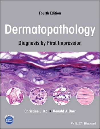 Dermatopathology Diagnosis by First Impression, 4th Edition