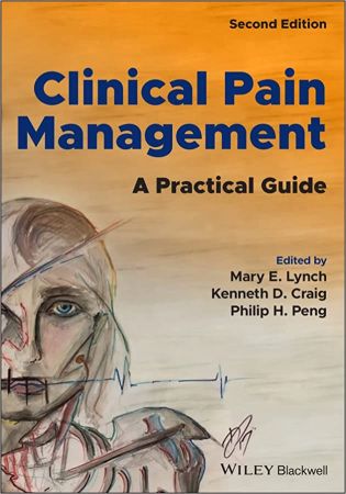 Clinical Pain Management A Practical Guide, 2nd Edition