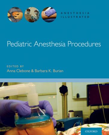 Pediatric Anesthesia Procedures (Anesthesia Illustrated)